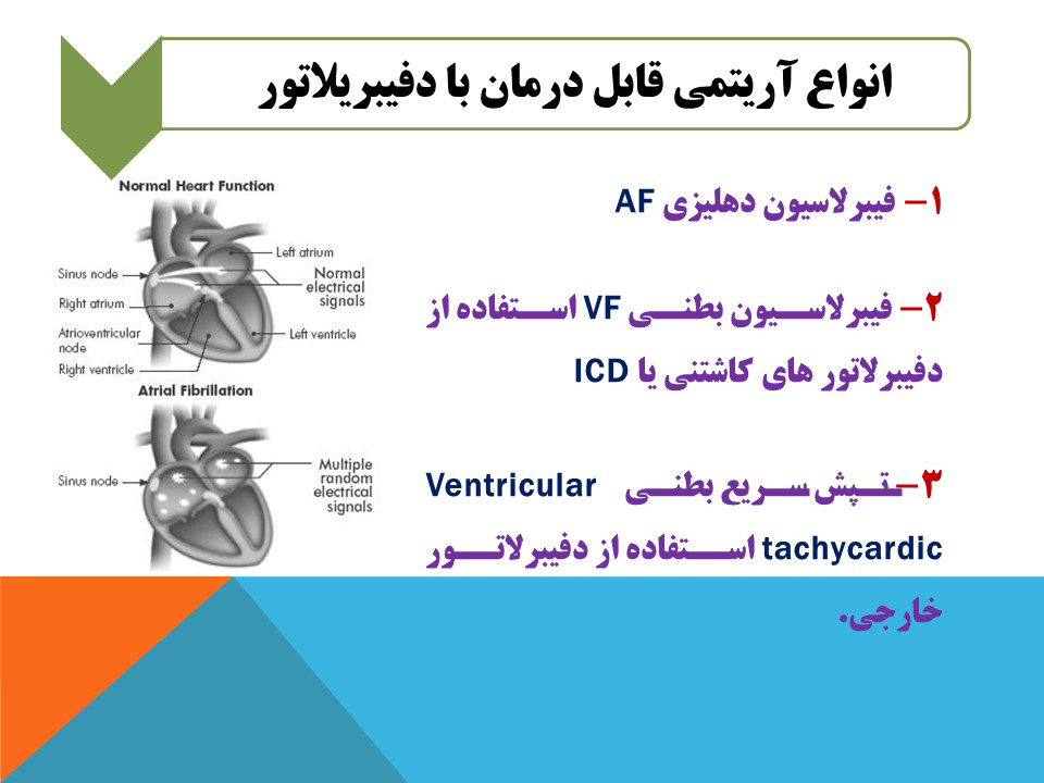 دستگاه دفیبریلاتور،انواع،قطعات و نحوه کار آن